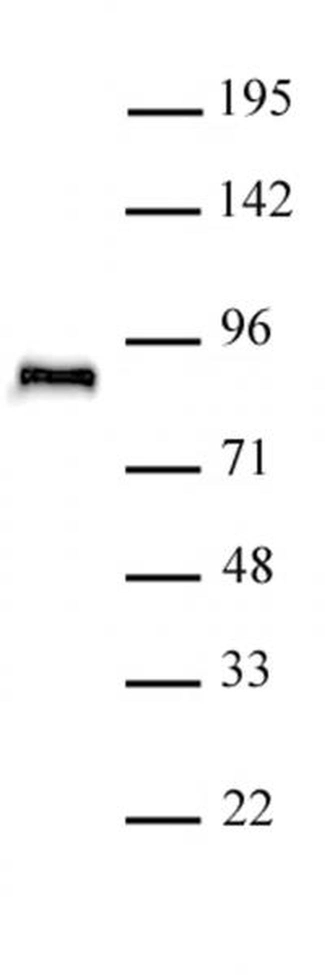 TCF4 Antibody in Western Blot (WB)