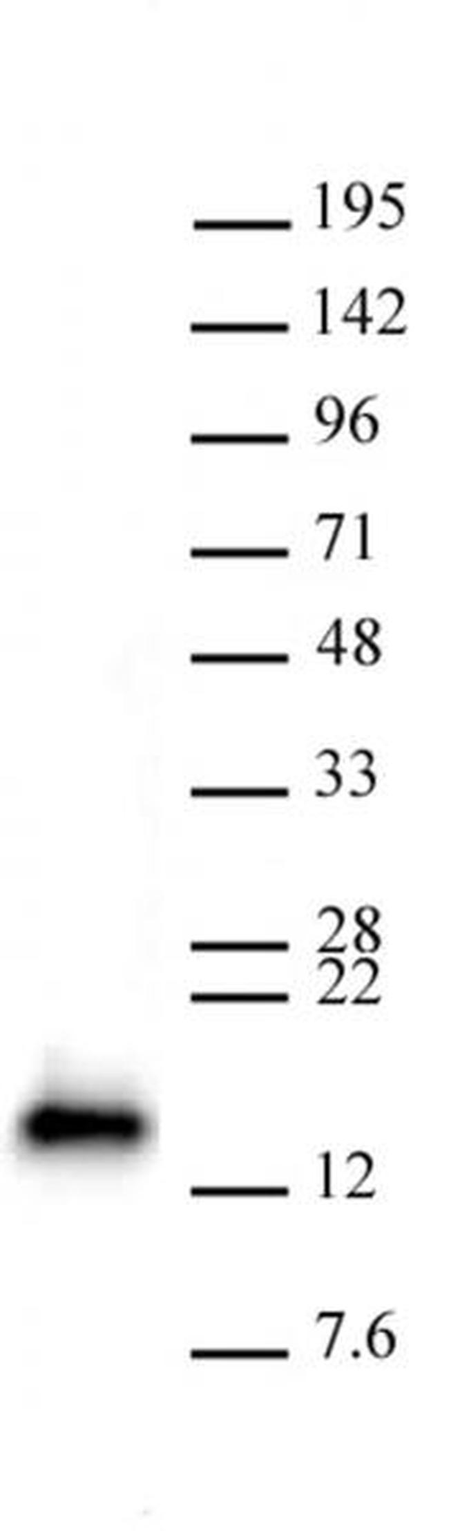 CDKN2A Antibody in Western Blot (WB)