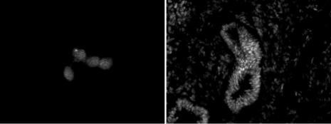 Chd5 Antibody in Immunocytochemistry (ICC/IF)