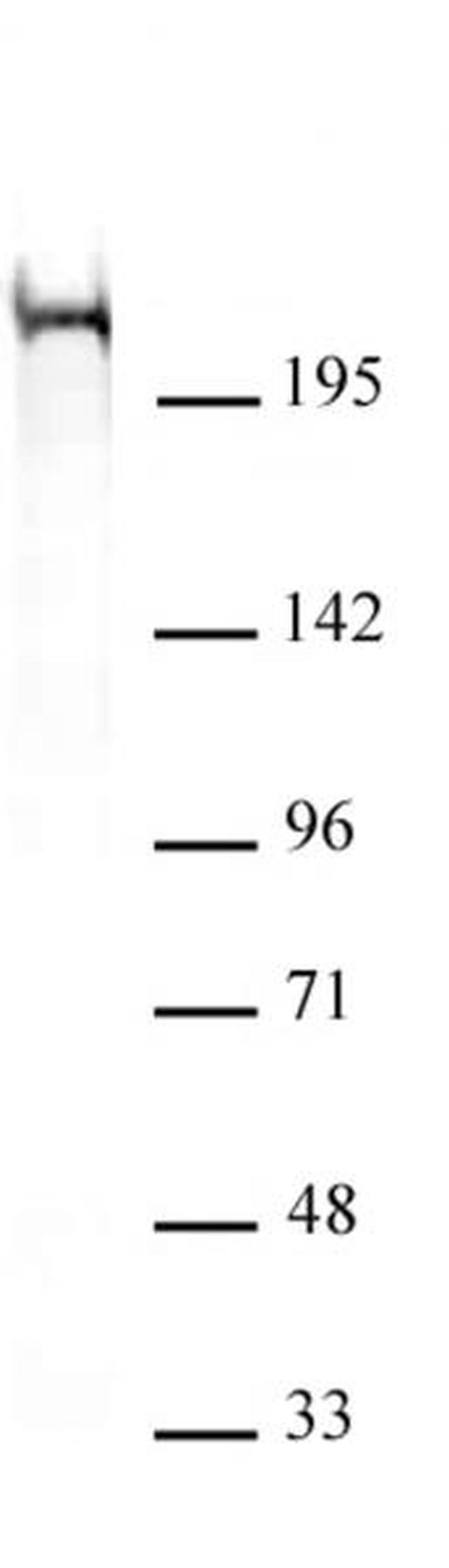 Chd5 Antibody in Western Blot (WB)