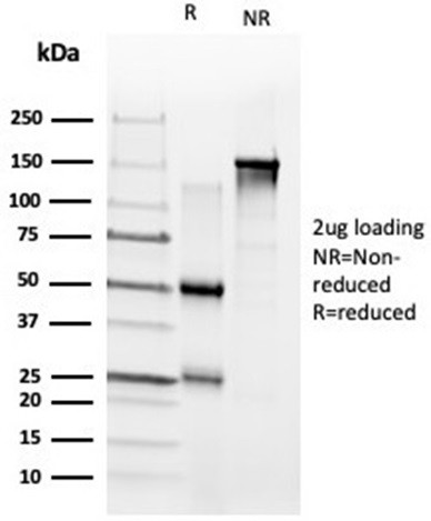 ZNF704/Zinc finger protein 704 Antibody in SDS-PAGE (SDS-PAGE)