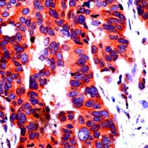 Notch 1 Antibody in Immunohistochemistry (Paraffin) (IHC (P))