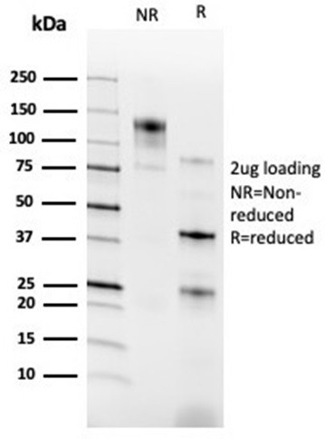 RXRG/NR2B3 (Transcription Factor) Antibody in SDS-PAGE (SDS-PAGE)