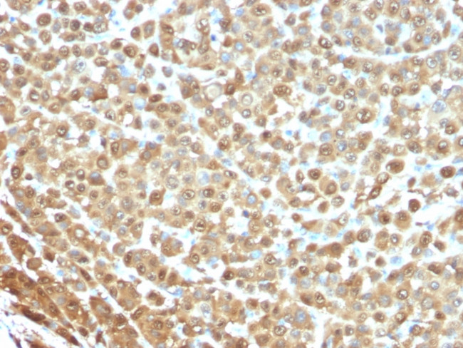 S100A1 (Melanoma Marker) Antibody in Immunohistochemistry (Paraffin) (IHC (P))