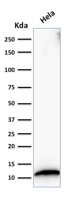 S100A4/Metastasin/Calvasculin (Marker of Tumor Metastasis) Antibody in Western Blot (WB)