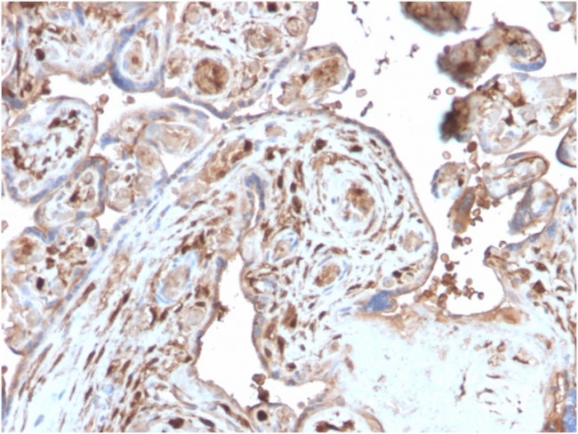 S100A4/Metastasin/Calvasculin Antibody in Immunohistochemistry (Paraffin) (IHC (P))