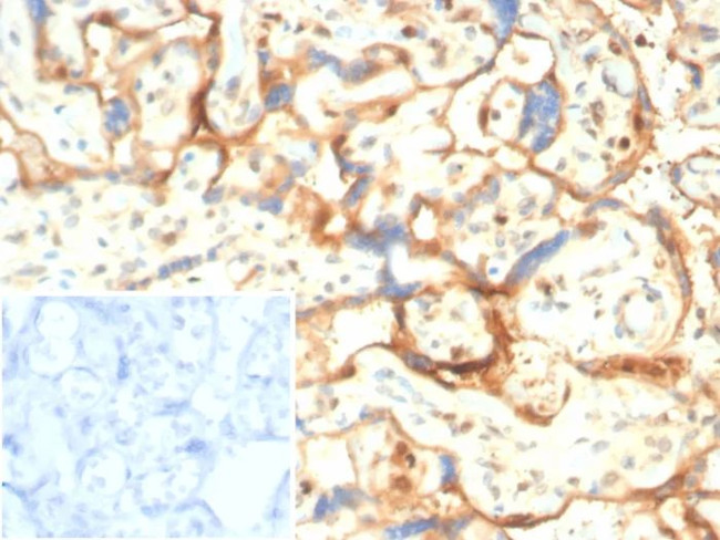 S100A11 (S100 calcium binding protein A11)/Calgizzarin Antibody in Immunohistochemistry (Paraffin) (IHC (P))