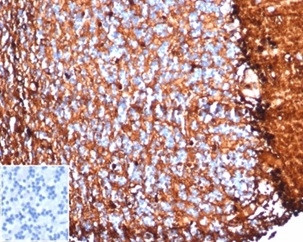 S100B (Astrocyte and Melanoma Marker) Antibody in Immunohistochemistry (Paraffin) (IHC (P))