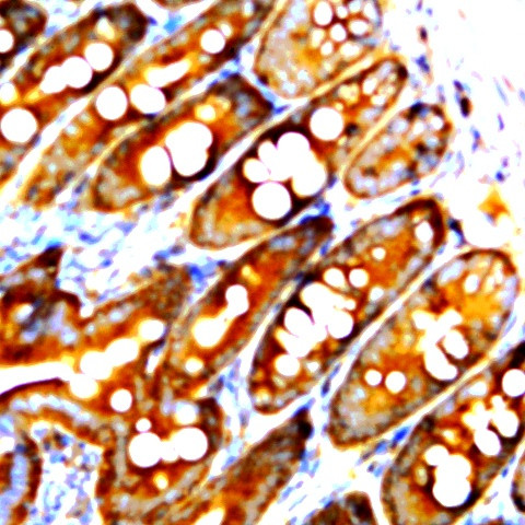 ZO-1 Antibody in Immunohistochemistry (Paraffin) (IHC (P))