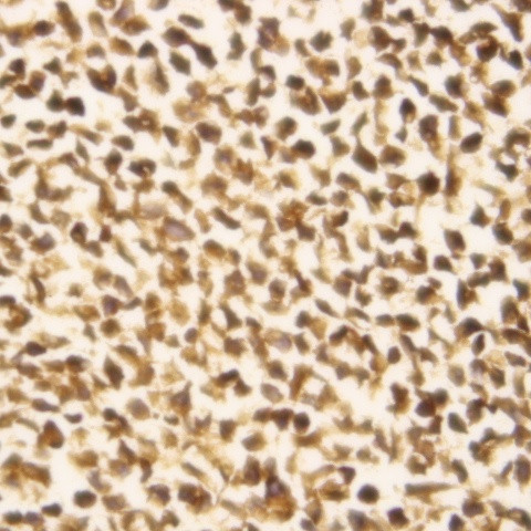 Phospho-STK17b (Ser11) Antibody in Immunocytochemistry (ICC/IF)