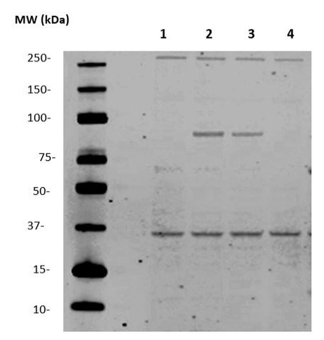 TWIST1/2 Antibody in Western Blot (WB)