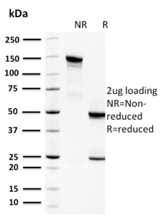 Spermidine or Spermine N1-Acetyltransferase 1 Antibody in SDS-PAGE (SDS-PAGE)