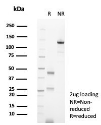 CD138/Syndecan-1 (SDC1) (Plasma Cell Marker) Antibody in SDS-PAGE (SDS-PAGE)