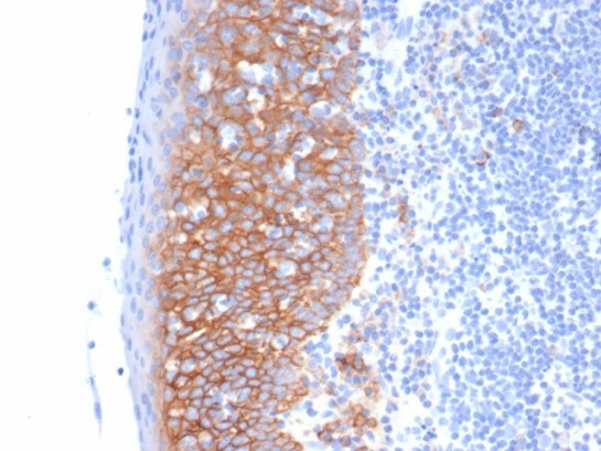 CD138/Syndecan-1 (SDC1) (Plasma Cell Marker) Antibody in Immunohistochemistry (Paraffin) (IHC (P))