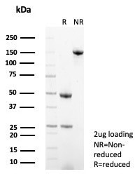 CD138/Syndecan-1 (SDC1) (Plasma Cell Marker) Antibody in SDS-PAGE (SDS-PAGE)