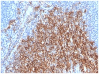 CD138/Syndecan-1 (SDC1) (Plasma Cell Marker) Antibody in Immunohistochemistry (Paraffin) (IHC (P))