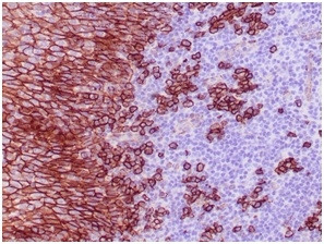 CD138/Syndecan-1 (SDC1) (Plasma Cell Marker) Antibody in Immunohistochemistry (Paraffin) (IHC (P))