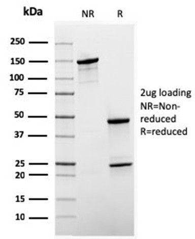 Sex Hormone Binding Globulin (SHBG) Antibody in SDS-PAGE (SDS-PAGE)