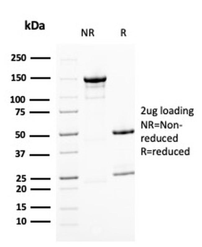 BMI1 Antibody in SDS-PAGE (SDS-PAGE)