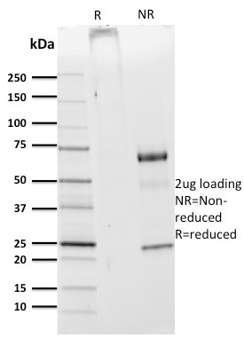 CDw75 (B-Cell Marker) Antibody in SDS-PAGE (SDS-PAGE)