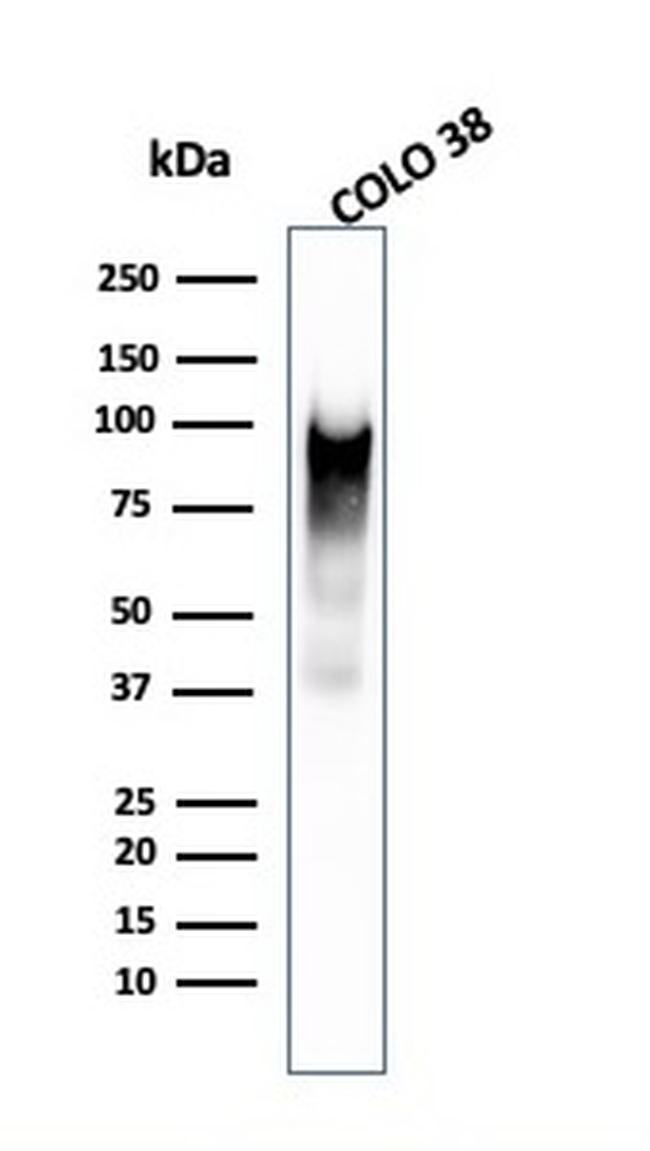 gp100/Melanosome/PMEL17/SILV Antibody in Western Blot (WB)
