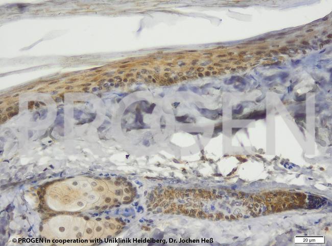 TIP47/PLIN3 Antibody in Immunohistochemistry (IHC)