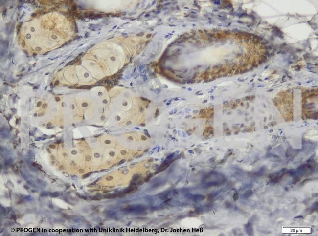 TIP47/PLIN3 Antibody in Immunohistochemistry (IHC)