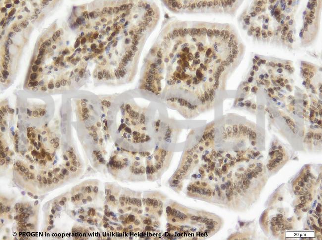 TIP47/PLIN3 Antibody in Immunohistochemistry (IHC)