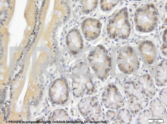 TIP47/PLIN3 Antibody in Immunohistochemistry (IHC)