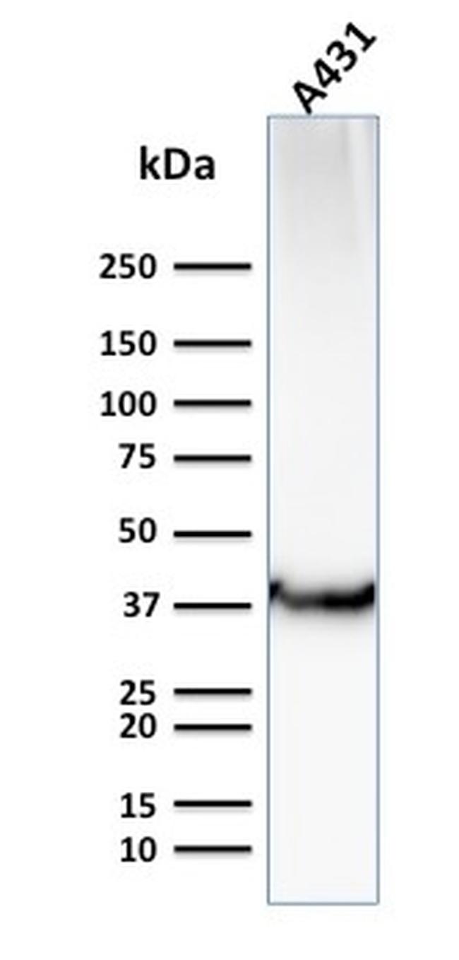 GLUT-1 Antibody in Western Blot (WB)