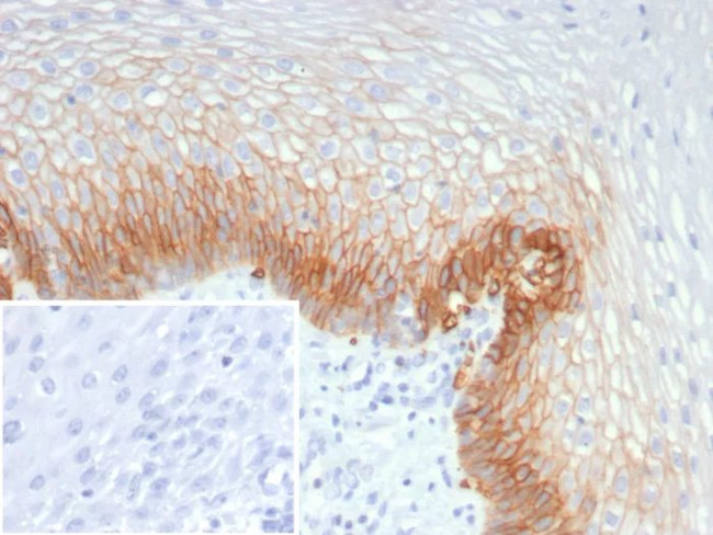 GLUT-1 (Tumor Progression and Mesothelioma Marker) Antibody in Immunohistochemistry (Paraffin) (IHC (P))