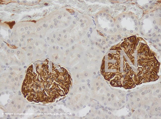 Synaptopodin Antibody in Immunohistochemistry (IHC)