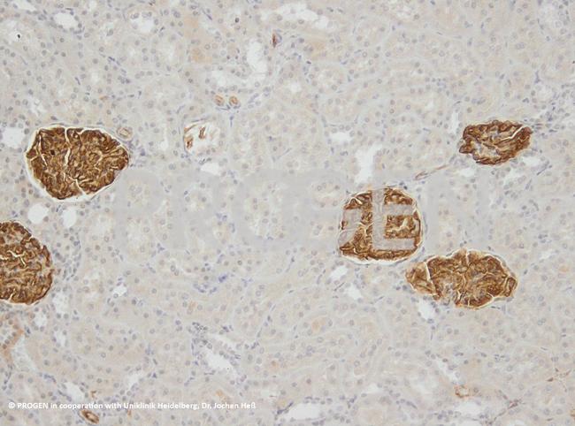 Synaptopodin Antibody in Immunohistochemistry (IHC)