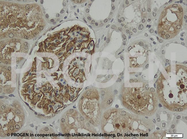 Synaptopodin Antibody in Immunohistochemistry (IHC)