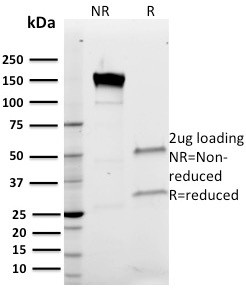 Band III Antibody in SDS-PAGE (SDS-PAGE)
