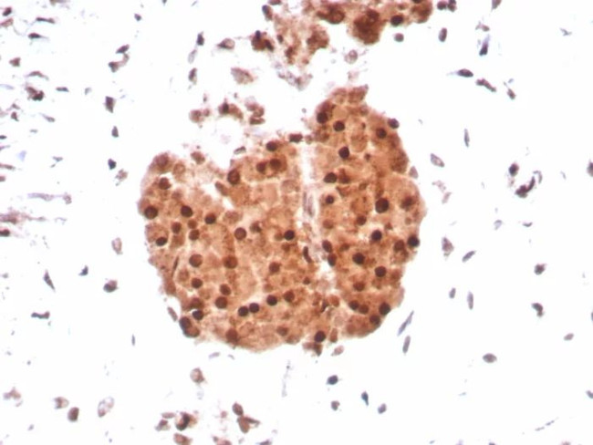 Integrase interactor 1 (INI-1)/SNF5/SMARCB1 Antibody in Immunohistochemistry (Paraffin) (IHC (P))