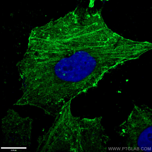 beta Actin Antibody in Immunocytochemistry (ICC/IF)