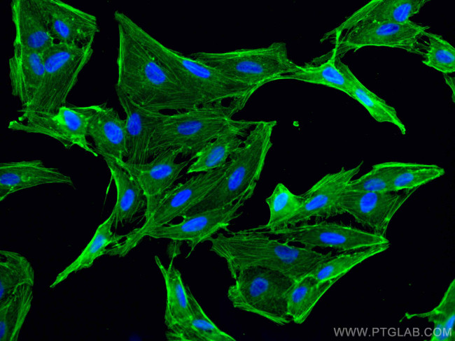 beta Actin Antibody in Immunocytochemistry (ICC/IF)