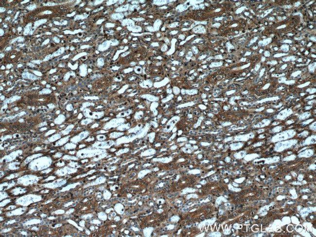 beta Actin Antibody in Immunohistochemistry (Paraffin) (IHC (P))