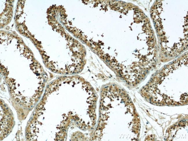 alpha Tubulin Antibody in Immunohistochemistry (Paraffin) (IHC (P))