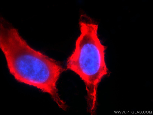 MGEA5 Antibody in Immunocytochemistry (ICC/IF)