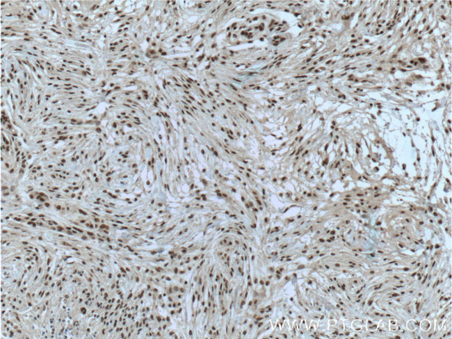 MGEA5 Antibody in Immunohistochemistry (Paraffin) (IHC (P))