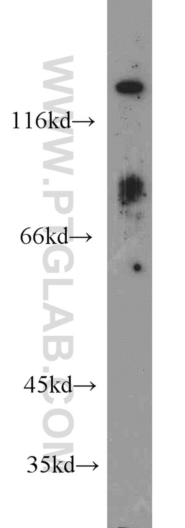 MGEA5 Antibody in Western Blot (WB)