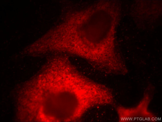 MGEA5 Antibody in Immunocytochemistry (ICC/IF)