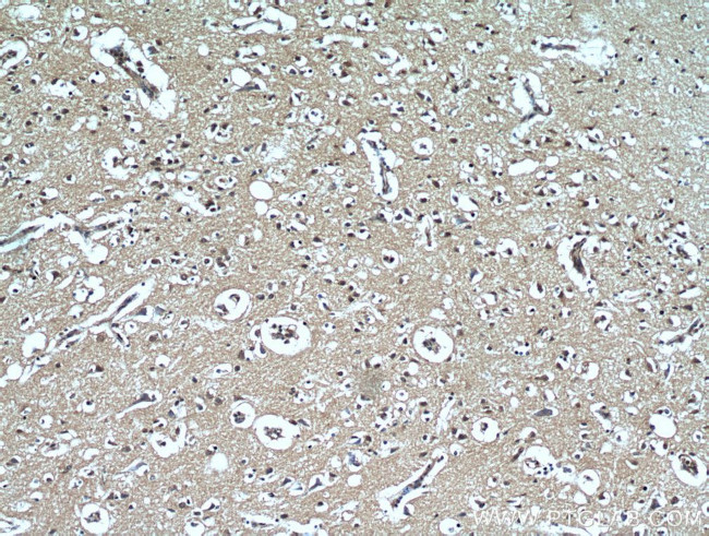 MGEA5 Antibody in Immunohistochemistry (Paraffin) (IHC (P))