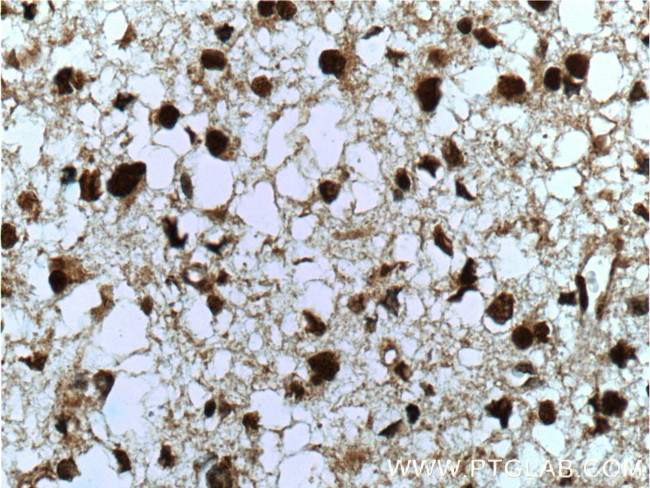 MGEA5 Antibody in Immunohistochemistry (Paraffin) (IHC (P))