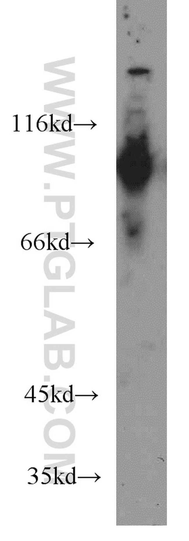 MGEA5 Antibody in Western Blot (WB)