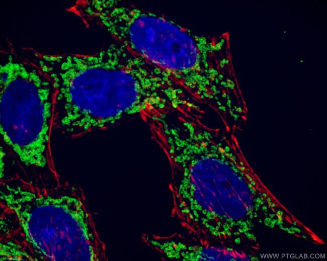 ATP5A1 Antibody in Immunocytochemistry (ICC/IF)