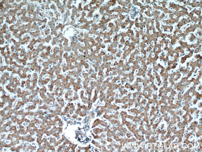 ATP5A1 Antibody in Immunohistochemistry (Paraffin) (IHC (P))