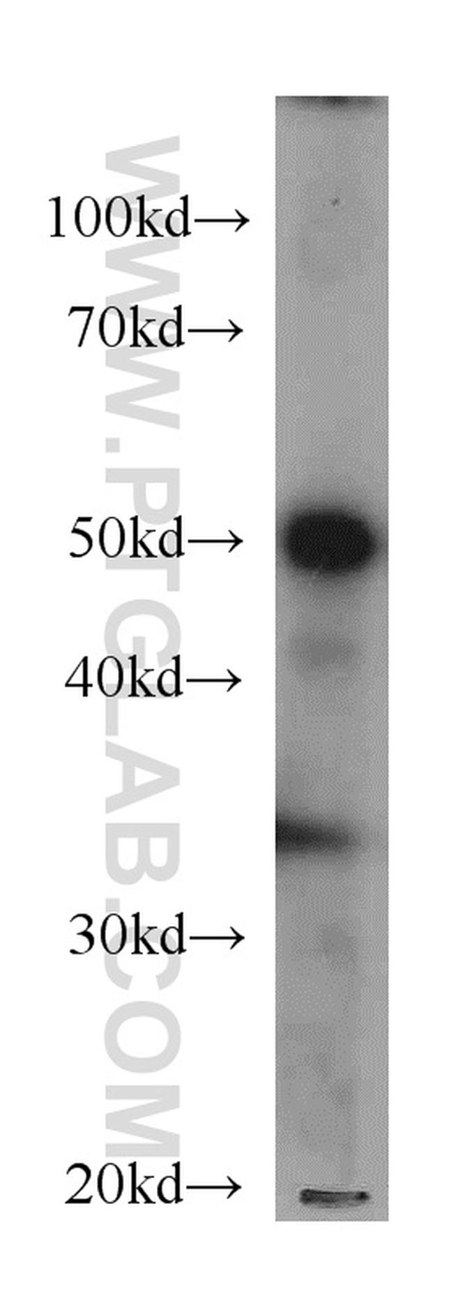 ATP5A1 Antibody in Western Blot (WB)